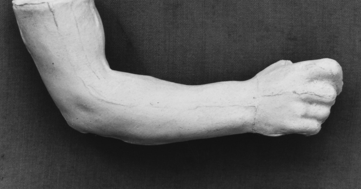 Plaster cast of an arm bent at the elbow with the hand closed in a fist, by Auguste Rodin.